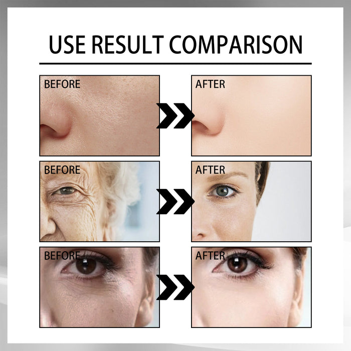 Snail Cream: Fade Wrinkles, Firm Skin Now